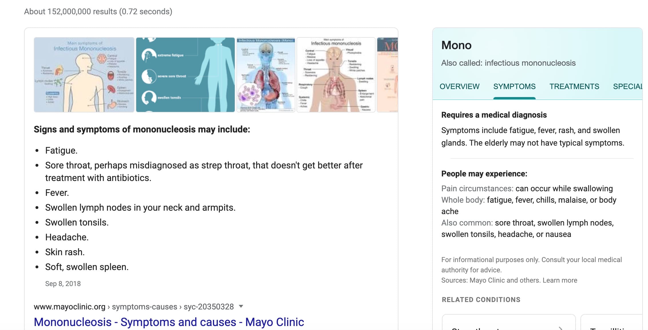 Mono Symptoms